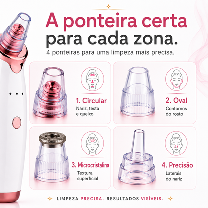 Removedor de Pontos Negros e Impurezas Profissional - PoreClean Pro™