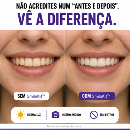 SmileKit™ V34 | Sérum Corretor de Tons Amarelados (COMPRA 1, LEVA 2)